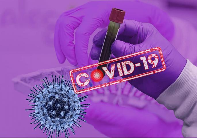 koronavirus-covid-19-2-1