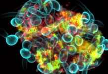 Naučnici slučajno otkrili ‘zlikovca’: Pogledajte šta se dešava u našim ustima i uništava nam zube