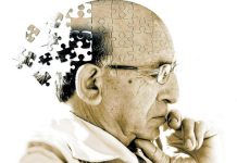 Razvijen lijek koji usporava propadanje mozga kod oboljelih od Alzheimerove bolesti