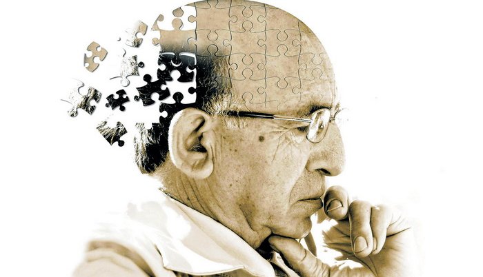 58356033-d540-41f9-bd0a-28f30a0a0a80-alzheimer-2-700x402-1
