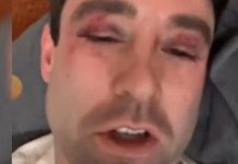 Poznatog meteorologa pretukla grupa tinejdžera