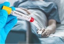 WHO sazvao hitan sastanak. U afričkoj zemlji širi se virus koji nema lijeka. Bilježe ga prvi put