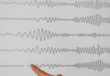 UDARIO JOŠ JEDAN RAZORAN ZEMLJOTRES! Tlo ne miruje, evo gdje se sada TRESLO