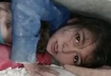 Sudbina djevojčice iz Sirije koja je spasila brata u ruševinama: Prijeti joj amputacija, možda više neće hodati…