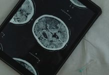 Muskova kompanija će ove godine izvršiti prvu implantaciju moždanog čipa